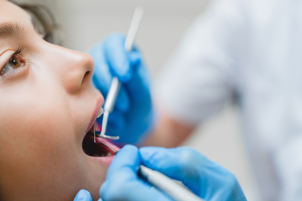 Getting A Dental Filling: A Step By Step Process